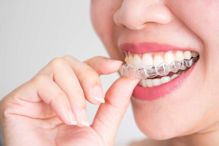 orthodontic dental care